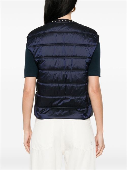 Gilet donna con dettagli gioielli LIU-JO | WA6231T334193924